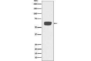 Western blot analysis of PLAT expression in human plasma lysate.