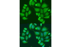 Immunofluorescence analysis of U2OS cells using CAPN2 antibody (ABIN2736399) at dilution of 1:100. (Calpain 2 抗体)