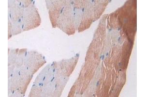 Immunohistochemistry (IHC) image for anti-Collagen, Type II, alpha 1 (COL2A1) (AA 1307-1383) antibody (ABIN7438682)