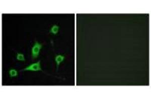 Immunofluorescence analysis of LOVO cells, using CRBP III antibody. (Retinol Binding Protein 5 抗体)