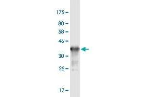 Western Blot detection against Immunogen (36. (RAB3B 抗体  (AA 120-219))