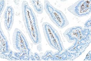 Immunohistochemistry (IHC) image for anti-Egf-Like Module Containing, Mucin-Like, Hormone Receptor-Like 1 (EMR1) (AA 28-225) antibody (ABIN7455124)