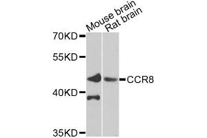 Western blot analysis of extracts of various cells, using CCR8 antibody. (CCR8 抗体)