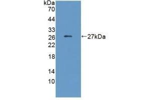 Detection of Recombinant CRP, Human using Monoclonal Antibody to C Reactive Protein (CRP) (CRP 抗体  (AA 17-224))