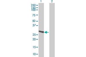 Western Blot analysis of METTL9 expression in transfected 293T cell line ( H00051108-T01 ) by METTL9 MaxPab polyclonal antibody. (METTL9 抗体  (AA 1-283))
