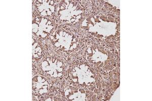 Immunohistochemical analysis of (ABIN391830 and ABIN2841673) on paraffin-embedded Human colon tissue. (HSP70 1A 抗体  (AA 19-48))