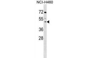 Western Blotting (WB) image for anti-Decapping Enzyme, Scavenger (DCPS) antibody (ABIN2999210) (DCPS 抗体)