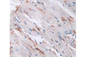 Used in DAB staining on fromalin fixed paraffin- embedded heart tissue (RHAG 抗体  (AA 251-450))