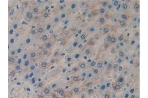 Detection of CFLAR in Rat Liver Tissue using Polyclonal Antibody to CASP8 And FADD Like Apoptosis Regulator (CFLAR) (FLIP 抗体  (AA 43-281))