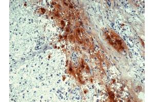 Immunohistochemistry staining of human pituitary gland (frozen sections) with anti-human beta Endorphin (B31. (beta Endorphin 抗体)