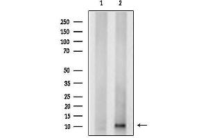 anti-Acyl-CoA Binding Domain Containing 7 (ACBD7) (Internal Region) antibody