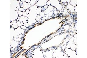 IHC-P: FGFR3 antibody testing of rat lung tissue (FGFR3 抗体  (N-Term))