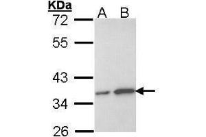 WB Image Sample (30 ug of whole cell lysate) A: Hela B: Hep G2 , 12% SDS PAGE antibody diluted at 1:1000 (OTUB1 抗体  (Center))