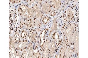 Immunohistochemistry (IHC) image for anti-Tumor Protein P53 (TP53) (pSer315) antibody (ABIN6256267)