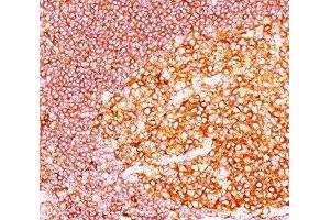 IHC staining of tonsil tissue with MALT1 antibody (MT1/410). (MALT1 抗体  (AA 701-808))