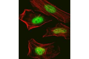 Fluorescent confocal image of Hela cell stained with Pan SUMO Antibody (ABIN388089 and ABIN2846043). (Pan SUMO 抗体)