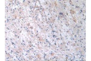 Figure. (TTR 抗体  (AA 21-147))