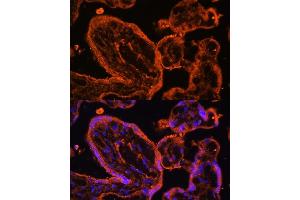 Immunofluorescence analysis of human placenta cells using LDB3 antibody (ABIN6128179, ABIN6143125, ABIN6143126 and ABIN6223347) at dilution of 1:100. (LIM Domain Binding 3 Protein 抗体  (AA 1-283))