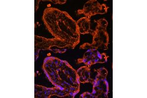 Immunofluorescence analysis of human placenta cells using LDB3 antibody (ABIN6128179, ABIN6143125, ABIN6143126 and ABIN6223347) at dilution of 1:100. (LIM Domain Binding 3 Protein 抗体  (AA 1-283))