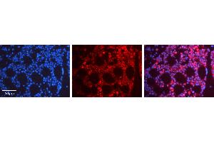 Immunohistochemistry (IHC) image for anti-c-Fos (c-Fos) (Middle Region) antibody (ABIN2779690)