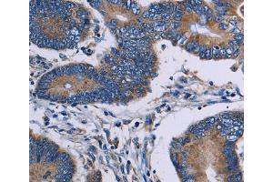 Immunohistochemistry (IHC) image for anti-IL2-Inducible T-Cell Kinase (ITK) antibody (ABIN2430324) (ITK 抗体)