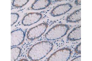 Used in DAB staining on fromalin fixed paraffin- embedded rectum tissue (Ribonuclease A10 (AA 27-216) 抗体)