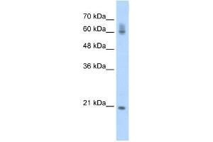 WB Suggested Anti-FIP1L1 Antibody Titration:  0. (FIP1L1 抗体  (C-Term))