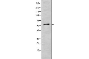 Western blot analysis of KR2_VZVD using HepG2 whole cell lysates (VZV Protein kinase ORF47 抗体)