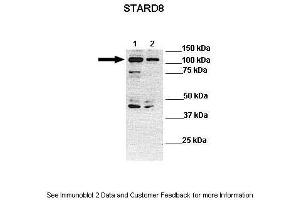 Lanes:  Lane 1: 30ug human HLE lysate Lane 2: 30ug human PLC/PRF-5 lysate  Primary Antibody Dilution:  1:1000 Secondary Antibody:  Anti-rabbit-HRP Anti-rabbit-HRP Secondary Antibody Dilution:  1:10,000 Gene Name:  STARD8 Submitted by:  Dr Frankie Ko Chi Fat, Lo-Kong Chan, Irene O. (STARD8 抗体  (N-Term))