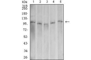 Western blot analysis using Dynamin-2 mouse mAb against Hela (1), U251 (2), K562 (3), Jurkat (4), and Ramos (5) cell lysate.