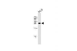 Anti-NDFIP1 Antibody (Center) at 1:1000 dilution + PC-3 whole cell lysate Lysates/proteins at 20 μg per lane. (NDFIP1 抗体  (AA 77-106))