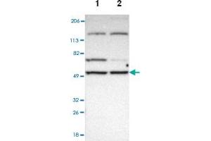 Western blot analysis of Lane 1: Human cell line RT-4, Lane 2: Human cell line U-251MG sp with MIPOL1 polyclonal antibody .