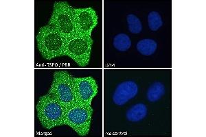 ABIN185697 Immunofluorescence analysis of paraformaldehyde fixed MCF7 cells, permeabilized with 0.