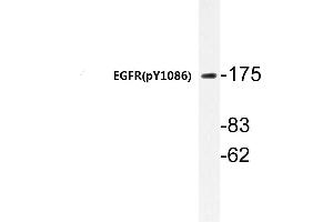 Western blot (WB) analyzes of p-EGFR antibody in extracts from HepG2 cells. (EGFR 抗体  (pTyr1110))