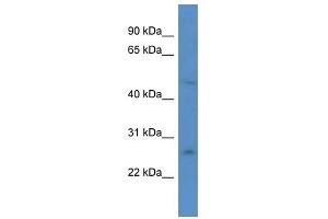 Western Blot showing ANKRD32 antibody used at a concentration of 1. (ANKRD32 抗体  (N-Term))