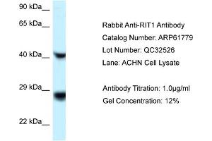 Western Blotting (WB) image for anti-Ras-Like Without CAAX 1 (RIT1) (C-Term) antibody (ABIN2788900) (RIT1 抗体  (C-Term))