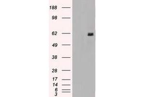 Image no. 2 for anti-Nuclear Receptor Binding Protein 1 (NRBP1) antibody (ABIN1499822)