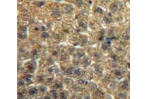 IHC-P analysis of Liver tissue, with DAB staining. (ITIH2 抗体  (AA 452-702))