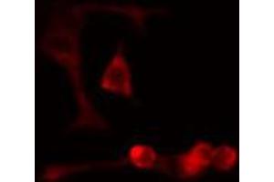 ABIN6274701 staining Hela cells by IF/ICC. (RAD51D 抗体  (C-Term))