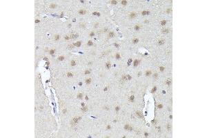 Immunohistochemistry (IHC) image for anti-CGRP Receptor Component (CRCP) (AA 1-115) antibody (ABIN1679351)