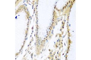 Immunohistochemistry of paraffin-embedded human stomach using MYBBP1A antibody at dilution of 1:100 (40x lens). (MYBBP1A 抗体)