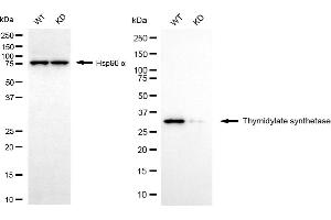 Western blotting analysis using thymidylate synthetase antibody (ABIN7800553).