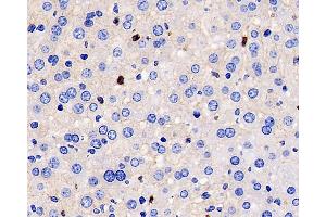 Immunohistochemistry (Paraffin-embedded Sections) (IHC (p)) image for anti-Matrix Metallopeptidase 9 (Gelatinase B, 92kDa Gelatinase, 92kDa Type IV Collagenase) (MMP9) antibody (ABIN7249784)
