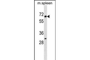 KLH22 Antibody (C-term) (ABIN1537487 and ABIN2849661) western blot analysis in mouse spleen tissue lysates (35 μg/lane). (KLHL22 抗体  (C-Term))