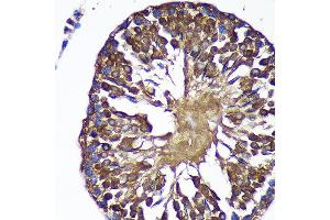 Immunohistochemistry of paraffin-embedded Rat testis using SENP1 Rabbit pAb (ABIN6132646, ABIN6147534, ABIN6147536 and ABIN6216945) at dilution of 1:100 (40x lens). (SENP1 抗体  (AA 220-420))
