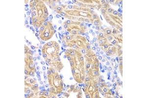 Immunohistochemistry (Paraffin-embedded Sections) (IHC (p)) image for anti-Aldehyde Dehydrogenase 2 Family (Mitochondrial) (ALDH2) (AA 1-380) antibody (ABIN3021779)