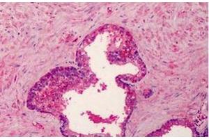 Formalin-Fixed, Paraffin-Embedded Human Placenta stained with BMP4 antibody at 5 µg/ml after heat-induced antigen retrieval. (BMP4 抗体)