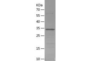 PPY Protein (AA 1-95) (His-IF2DI Tag)