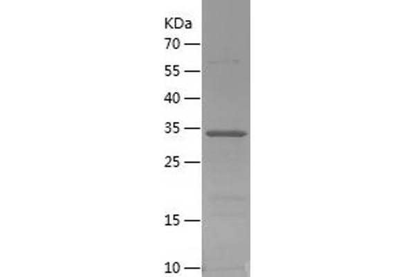 PPY Protein (AA 1-95) (His-IF2DI Tag)