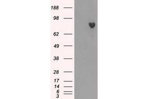 HEK293T cells were transfected with the pCMV6-ENTRY control (Left lane) or pCMV6-ENTRY BTK (Right lane) cDNA for 48 hrs and lysed. (BTK 抗体)